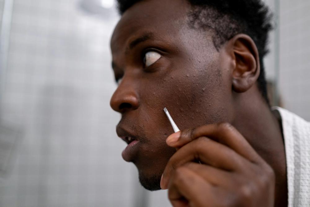 maleface acne remedy